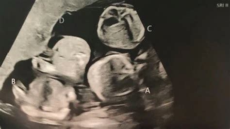 Woman Discovers She Is Naturally Pregnant With Quadruplets During Scan