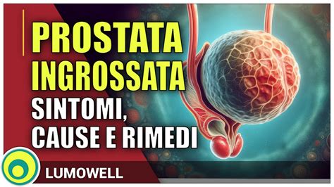 Prostata Ingrossata Sintomi Cause E Rimedi Youtube