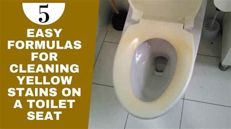 Easy Formulas For Cleaning Yellow Stains On A Toilet Seat Youtube