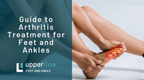 Guide To Arthritis Treatment For Feet And Ankles