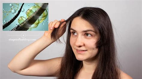 How To Regrow Lost Hair Naturally In 15 Minutes A Day Stages Of Balding