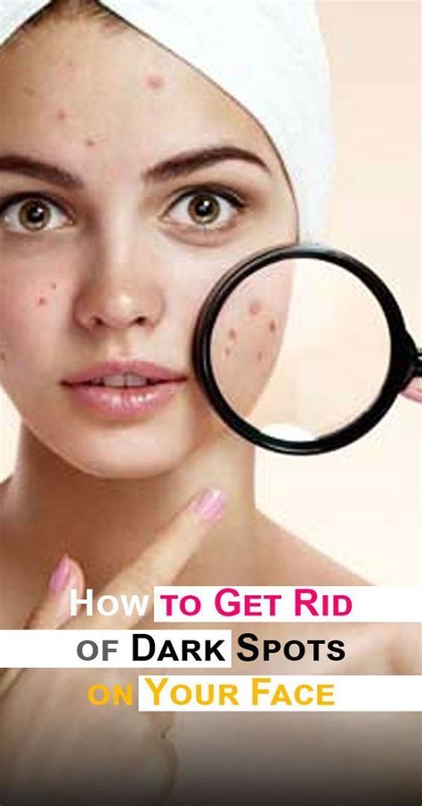 How To Get Rid Of Dark Spots On Your Face Skintagremovalhelp