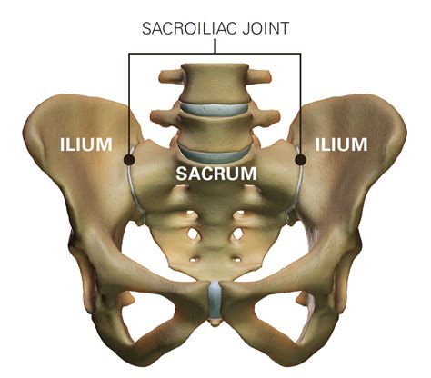 Sacroiliac Joint Dysfunction Presentation And Treatment Bone And Spine