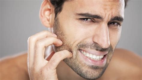 6 Steps To Avoid Neck Irritation After Shaving Beard Style