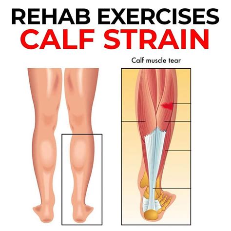 Calf Strain Rehab Exercises The Calf Muscle Consist Of The Gastrocnemius And Soleus Which