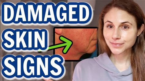 How To Tell When Your Skin Barrier Is Damaged Dr Dray Youtube