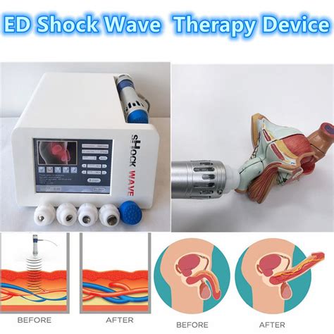 Protable Ed Shockwave Low Intensity Shockwave Therapy For Erectile Dysfunction And Physicaly For
