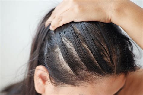 How To Tell If Your Hair Is Thinning And 7 Things That Can Help