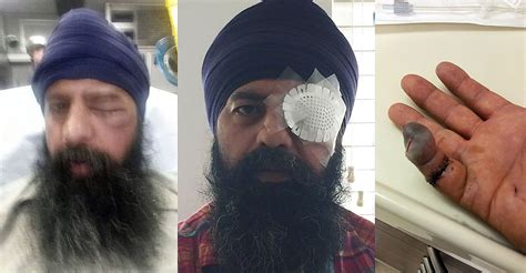 Attackers Assault Sikh Man Remove Turban Cut Off His