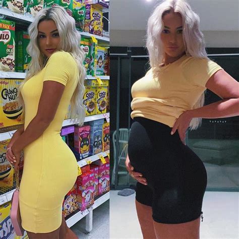 Instagram Model Shocks With 5 Hour Bloating Transformation Photo