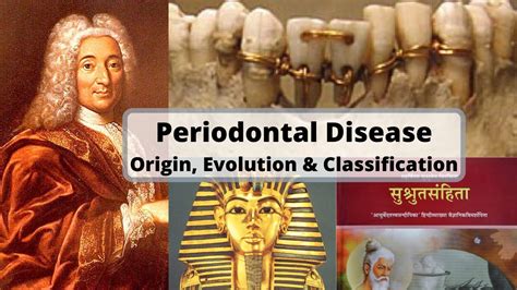 Periodontal Disease Origin Evolution And Classification Youtube