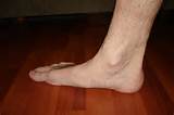 Images of Foot Flat