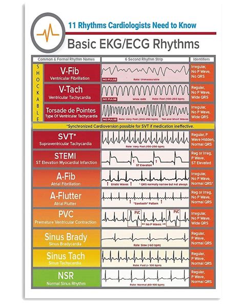 Gearsly Cardiologist Basic Ekg Ecg Rhythms Common And Formal Rhythm