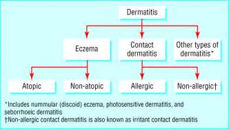 Atopic And Non Atopic Eczema The Bmj