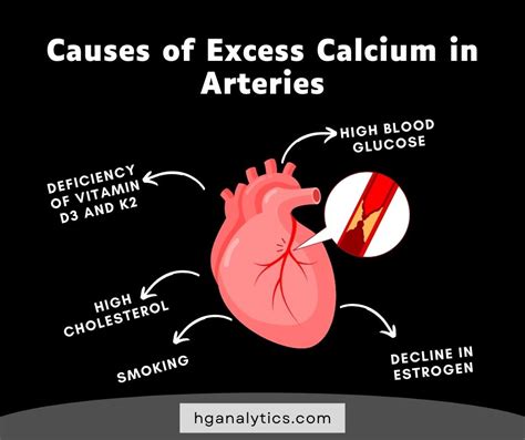 what causes calcium in arteries complete guide