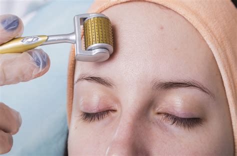 The Derma Microneedle Roller Can Improve Your Skin