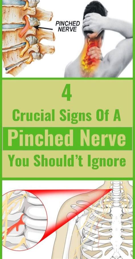 4 Crucial Signs Of A Pinched Nerve You Really Shouldt Ignore