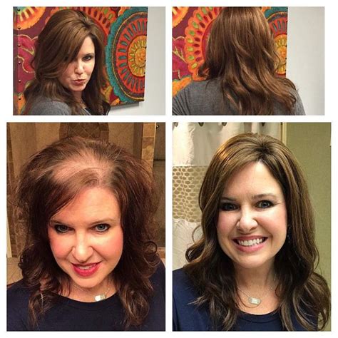 Well, there have been developments. Hair toppers for women with thinning hair or hair loss ...