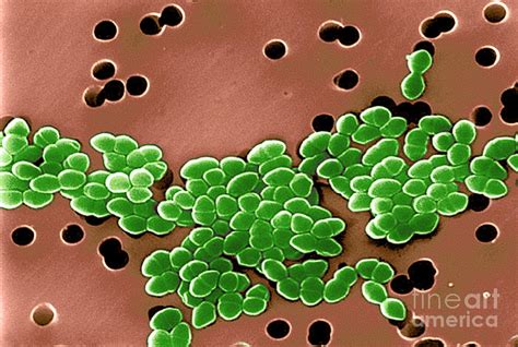 Vancomycin Resistant Enterococci By Science Source