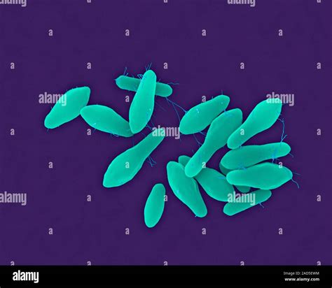 Coloured Scanning Electron Micrograph Sem Of Clostridium Tetani