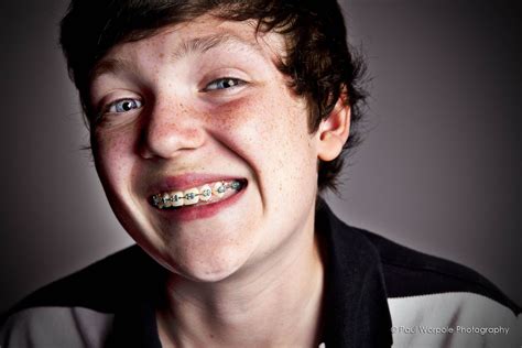 Kid With A Brace Face Advertising Portrait Professional Corporate