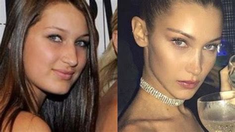 She says people will one day complain you have no behind and. BELLA HADID TRANSFORMATION (plastic surgery assumptions ...