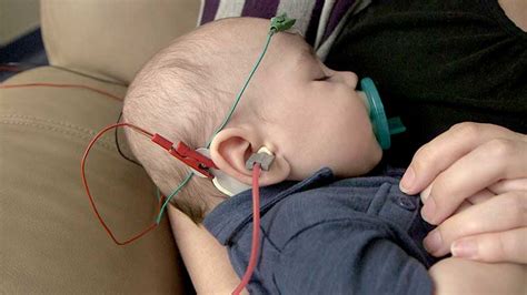 Newborn Hearing Screening