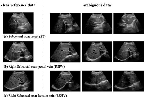 Sensors Free Full Text Real Time Deep Recognition Of Standardized Liver Ultrasound Scan