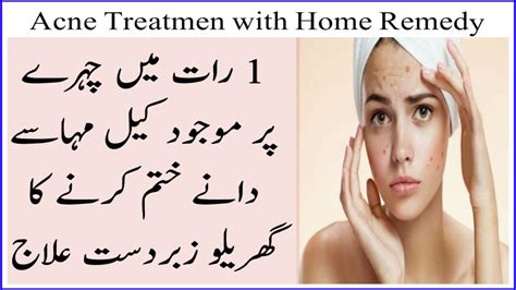 To Get Acne Treatment With Home Remedy 100 Results Youtube