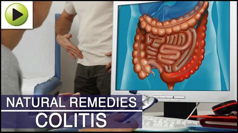 Colitis Natural Ayurvedic Home Remedies Youtube