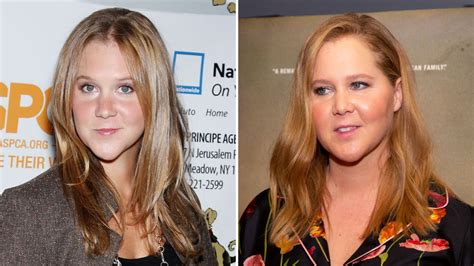 Did Amy Schumer Get Plastic Surgery Transformation Photos Life And Style