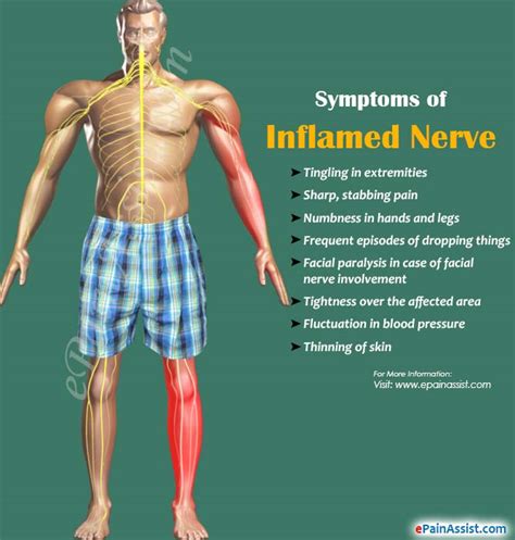 Causes Symptoms Of Inflamed Nerve And Its Treatment Prognosis