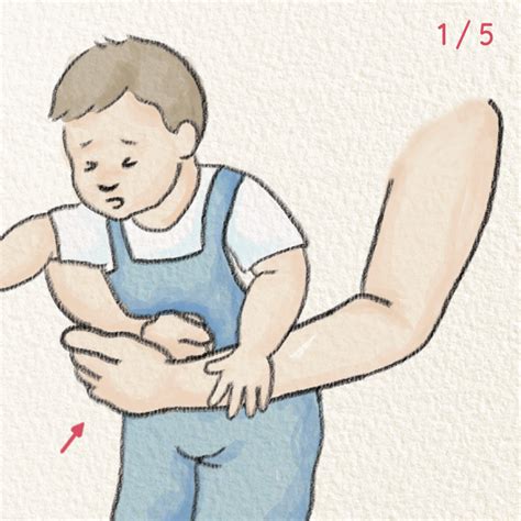 How To Save Choking Children One Year Up