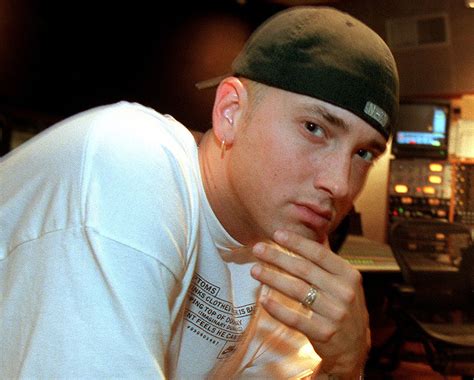 Did Eminem Have Plastic Surgery Bdcwire