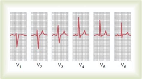 How To Read A Normal Ecgelectrocardiogram Hubpages