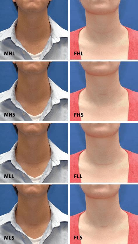 Reproductions Of Thyroidectomy Scars On The Necks Of A Normal Male M