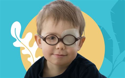 Tahukah Anda Tentang Gangguan Mata Malas Amblyopia VIO Optical Clinic Klinik Mata