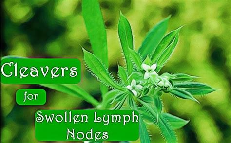 21 Natural Home Remedies For Swollen Lymph Nodes In Neck And More Page 2