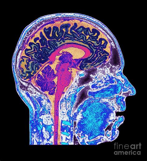 Normal Human Brain Mri Scan Photograph By Du Cane Medical Imaging Ltd