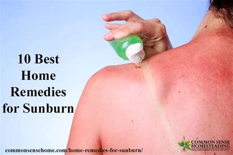 Whats Good For Sunburn Check Out These Home Remedies For Sunburn