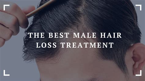 The Best Male Hair Loss Treatment In 2023 Nutri Inspector