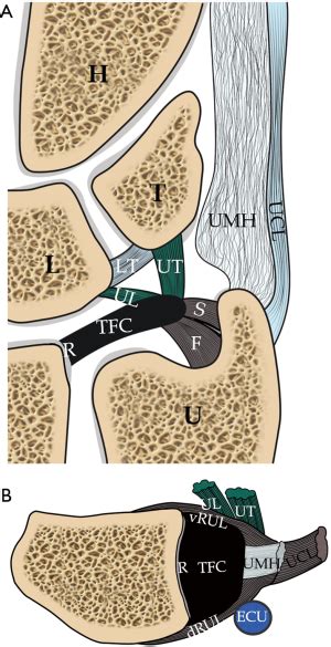 Mr Imaging Of The Traumatic Triangular Fibrocartilaginous Complex Tear Ng Quantitative