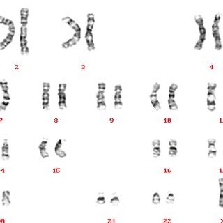 PDF Cytogenetic Techniques In Diagnosing Genetic Disorders
