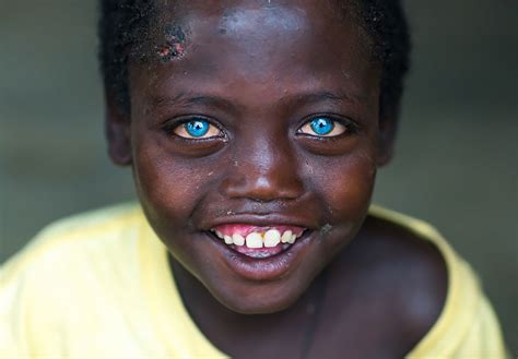 Abushe The Ethiopian Boy Bullied For His Beautiful Blue Eyes Travel