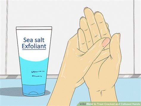 How To Treat Cracked And Callused Hands With Pictures Wikihow