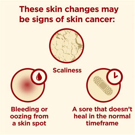Skin Cancer Statistics Facts And You Healthline