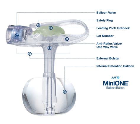 Minione Balloon Applied Medical Technology