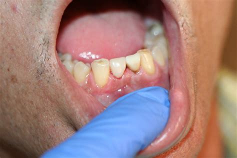 Broken Tooth Magic Mcfarlane Dental