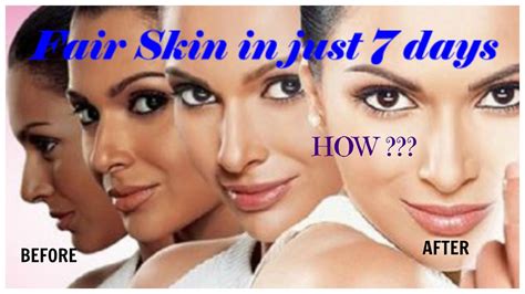 Get Fair Skin In Just 7 Daysmiracle Remedy Perfect For All Skin Type