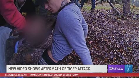 New Video Shows Aftermath Of Tiger Attack That Nearly Ripped Off 18